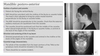 Radiographic technique of skull | PPTX
