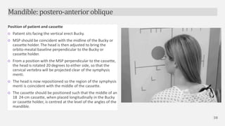 Radiographic technique of skull | PPTX