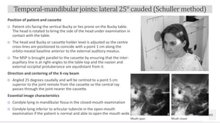 Radiographic technique of skull | PPTX