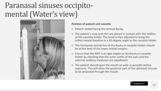 Radiographic technique of skull | PPTX