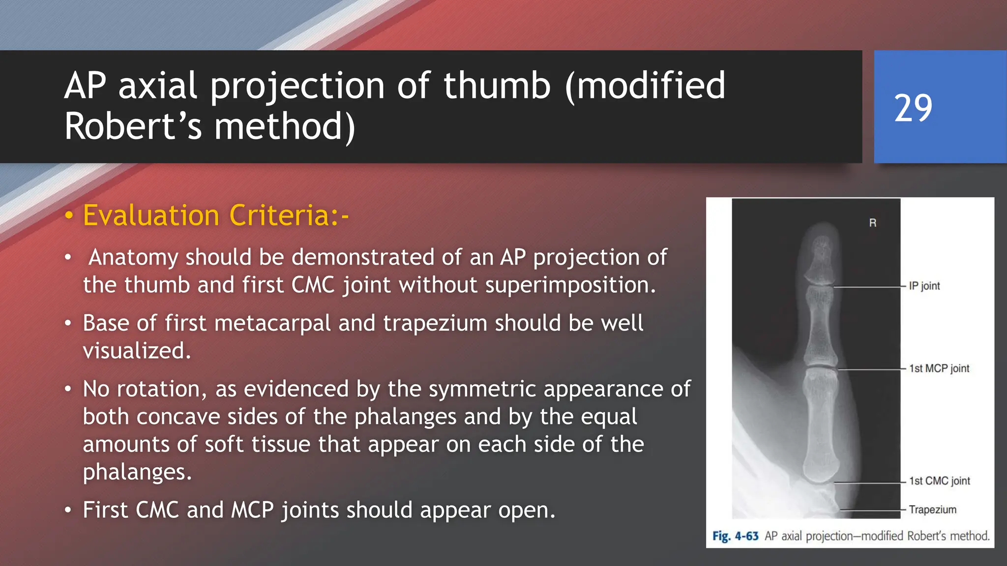 RADIOGRAPHIC TECHNIQUE OF UPPER LIMB BY SAGAR CHAULAGAIN | PPTX