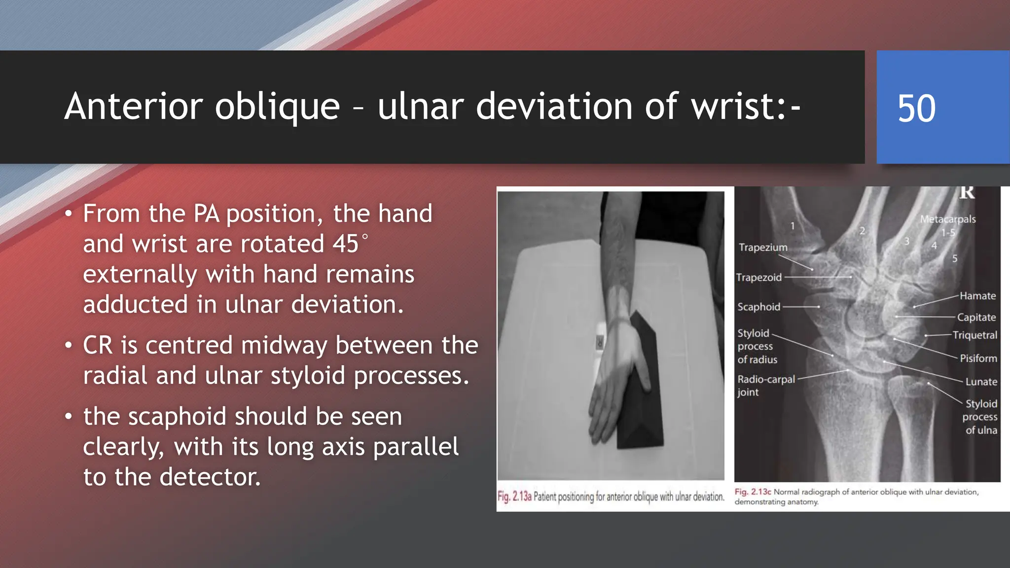 Hand Deviation RADIOGRAPHIC TECHNIQUE OF UPPER LIMB BY SAGAR CHAULAGAIN | PPTX