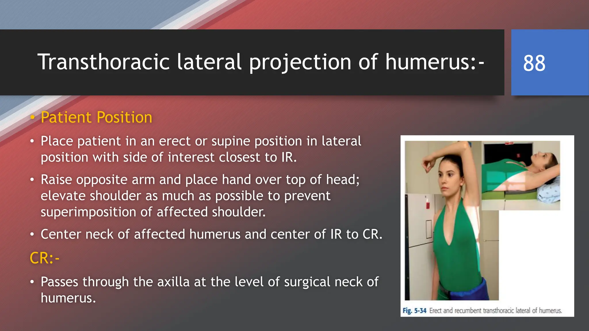 RADIOGRAPHIC TECHNIQUE OF UPPER LIMB BY SAGAR CHAULAGAIN | PPTX