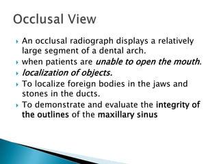    An occlusal radiograph displays a relatively
    large segment of a dental arch.
   when patients are unable to open the mouth.
   localization of objects.
   To localize foreign bodies in the jaws and
    stones in the ducts.
   To demonstrate and evaluate the integrity of
    the outlines of the maxillary sinus
 