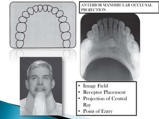 ANTERIOR MANDIBULAR OCCLUSAL
 PROJECTION




• Image Field
• Receptor Placement
• Projection of Central
  Ray
• Point of Entry
 