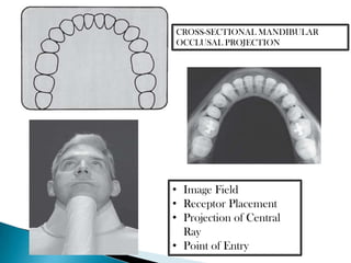 CROSS-SECTIONAL MANDIBULAR
OCCLUSAL PROJECTION




• Image Field
• Receptor Placement
• Projection of Central
  Ray
• Point of Entry
 