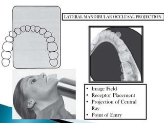 LATERAL MANDIBULAR OCCLUSAL PROJECTION




        • Image Field
        • Receptor Placement
        • Projection of Central
          Ray
        • Point of Entry
 