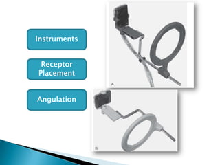 Instruments


 Receptor
Placement


Angulation
 