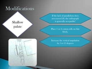 If the lack of parallelism does
          not exceed 20, the radiograph
              is generally acceptable.̊
Shallow
 palate
          Place 1 or 2 cotton rolls on bite
                       block.


          Increase the vertical angulation
                by 5 to 15 degrees
 