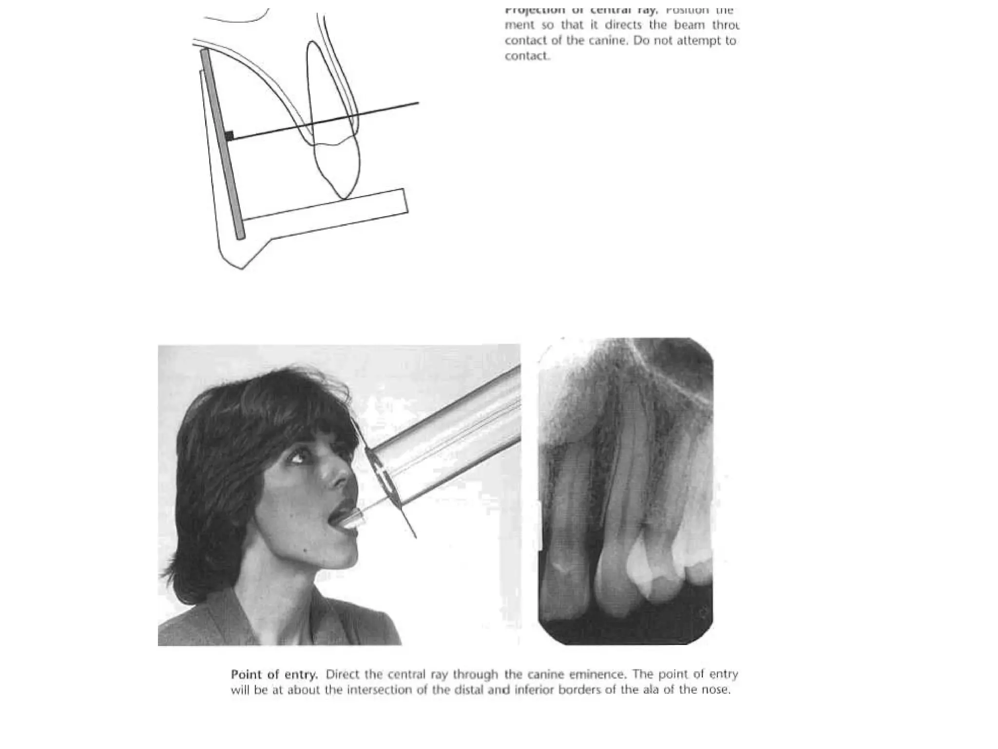 Radiographic techniques | PPT