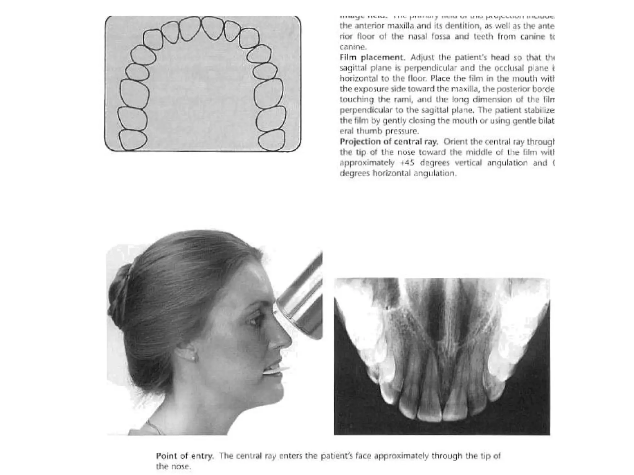 Radiographic techniques | PPT