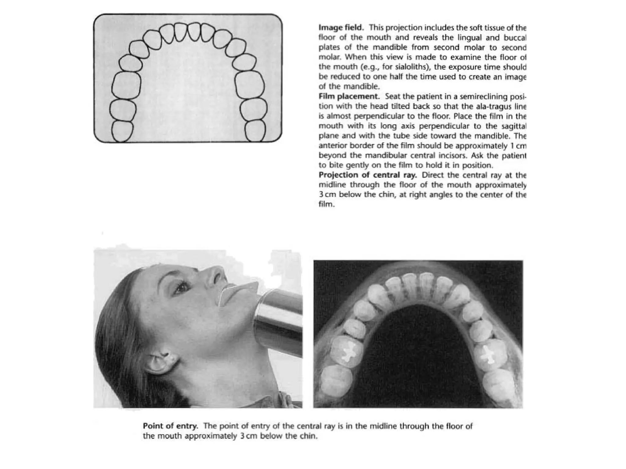 Radiographic techniques | PPT