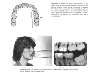 Radiographic techniques | PPT