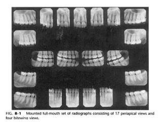 Radiographic techniques | PPT