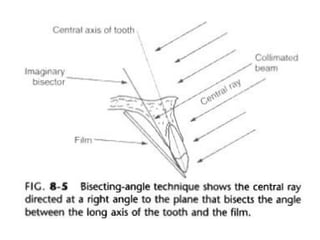 Radiographic techniques | PPT