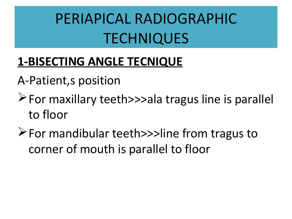 Radiographic techniques