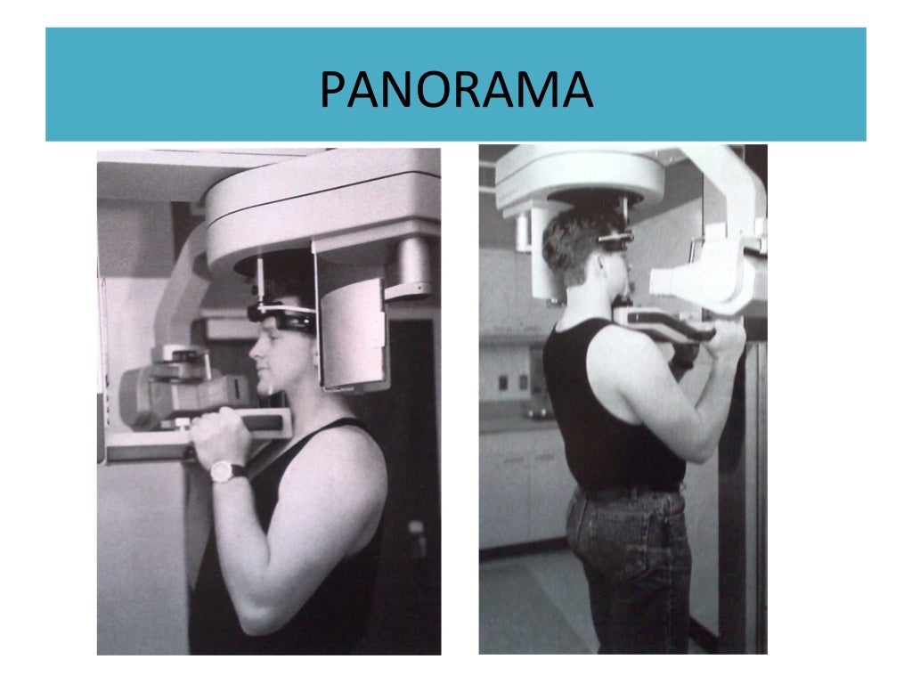 Radiographic techniques