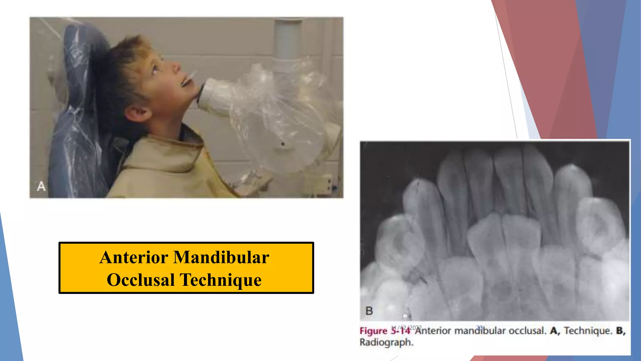 Radiographic Techniques.pptx