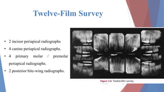 Twelve-Film Survey
11/12/2022 14
• 2 incisor periapical radiographs
• 4 canine periapical radiographs.
• 4 primary molar / premolar
periapical radiographs.
• 2 posterior bite-wing radiographs.
 