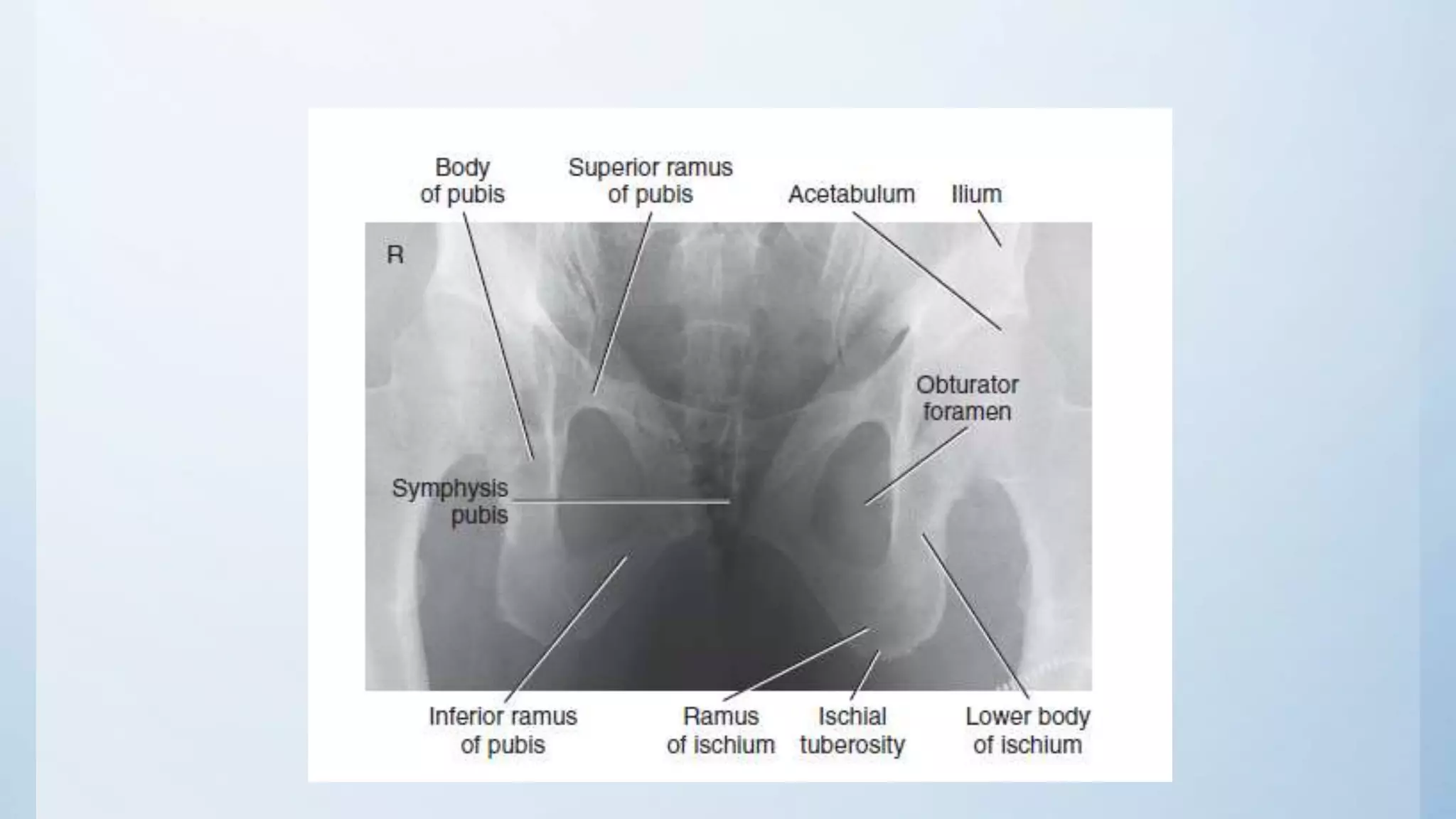 Radiographic views of proximal femur and pelvis | PPTX