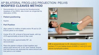 Radiographic views of proximal femur and pelvis | PPTX