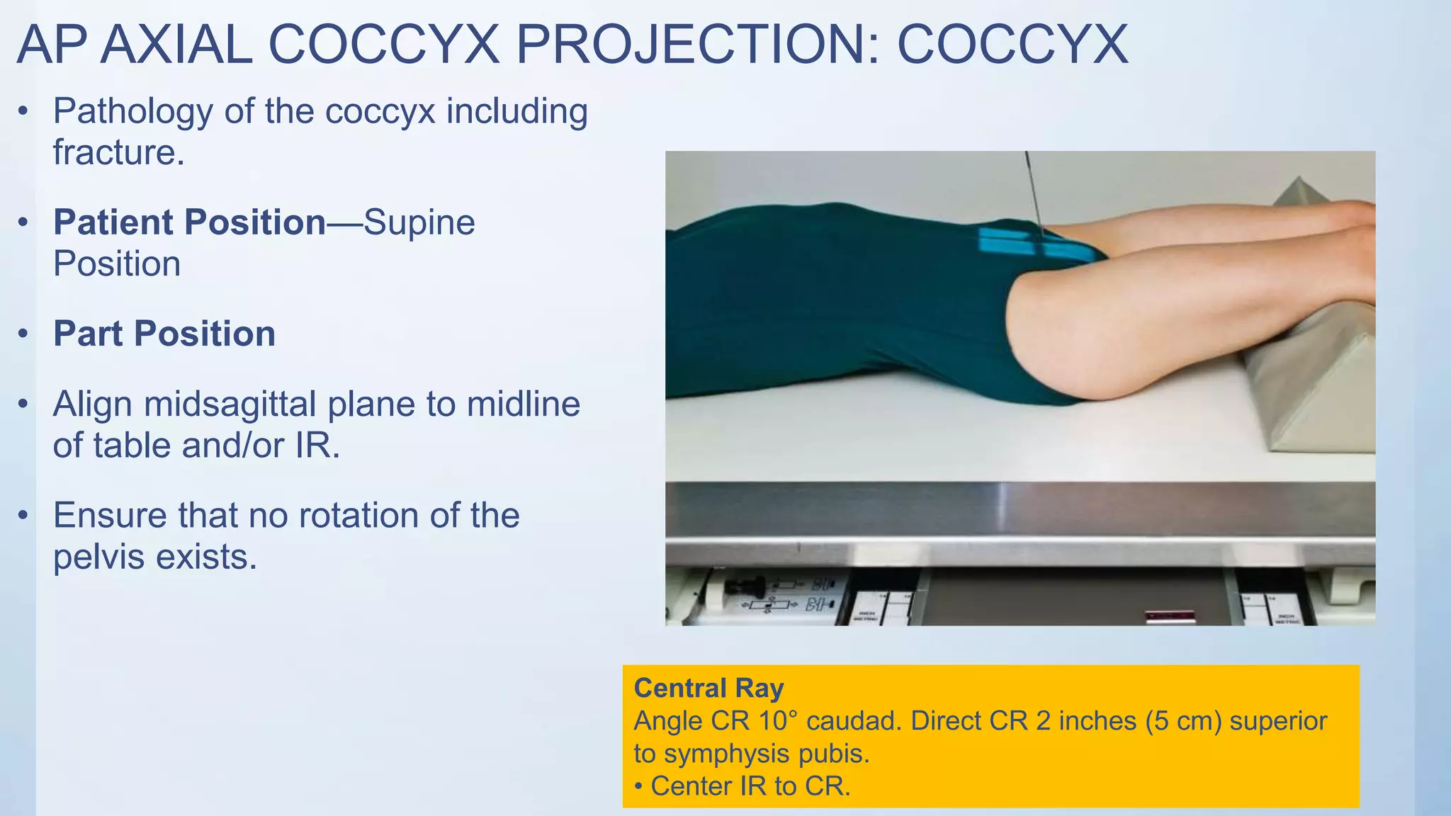 AP AXIAL COCCYX PROJECTION: COCCYX
• Pathology of the coccyx including
fracture.
• Patient Position—Supine
Position
• Part Position
• Align midsagittal plane to midline
of table and/or IR.
• Ensure that no rotation of the
pelvis exists.
Central Ray
Angle CR 10° caudad. Direct CR 2 inches (5 cm) superior
to symphysis pubis.
• Center IR to CR.
 