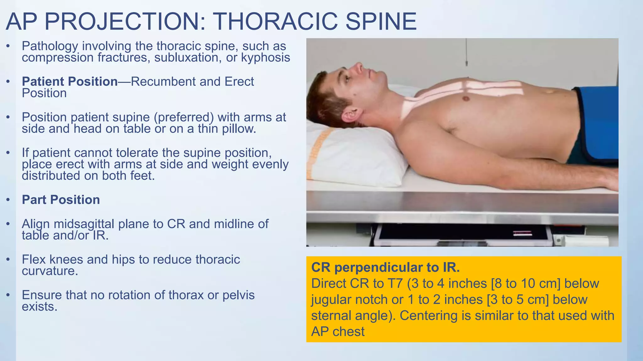 AP PROJECTION: THORACIC SPINE
• Pathology involving the thoracic spine, such as
compression fractures, subluxation, or kyphosis
• Patient Position—Recumbent and Erect
Position
• Position patient supine (preferred) with arms at
side and head on table or on a thin pillow.
• If patient cannot tolerate the supine position,
place erect with arms at side and weight evenly
distributed on both feet.
• Part Position
• Align midsagittal plane to CR and midline of
table and/or IR.
• Flex knees and hips to reduce thoracic
curvature.
• Ensure that no rotation of thorax or pelvis
exists.
CR perpendicular to IR.
Direct CR to T7 (3 to 4 inches [8 to 10 cm] below
jugular notch or 1 to 2 inches [3 to 5 cm] below
sternal angle). Centering is similar to that used with
AP chest
 