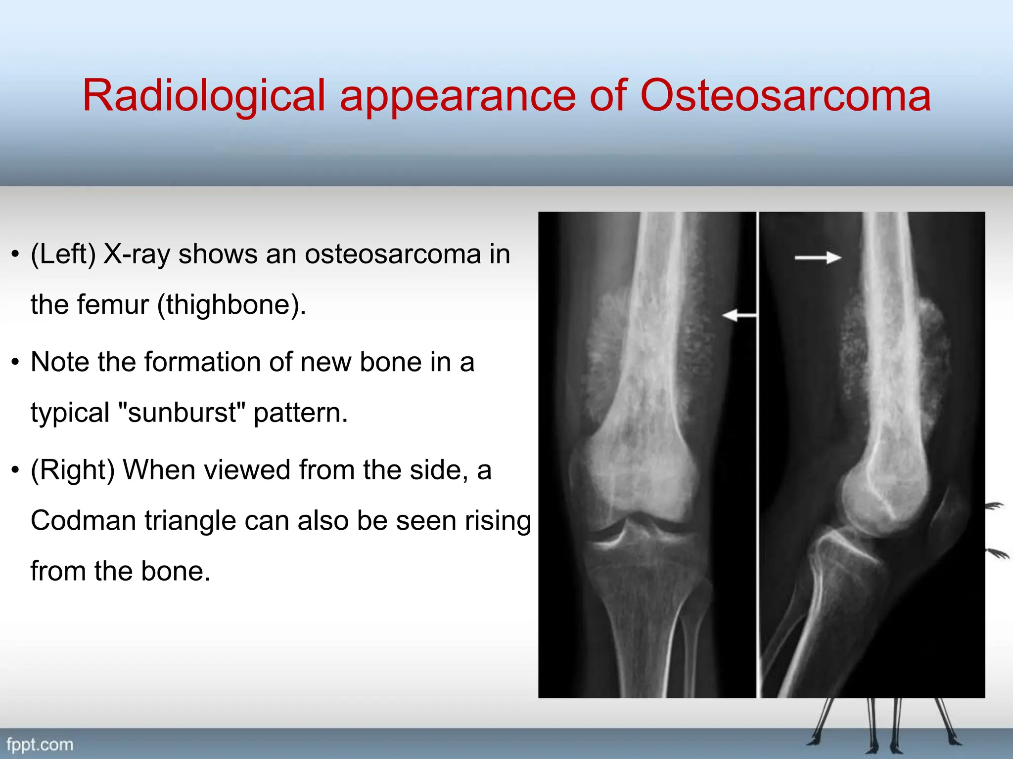 Radiograph of Skeletal System.pptmmmmmmmm | PPT