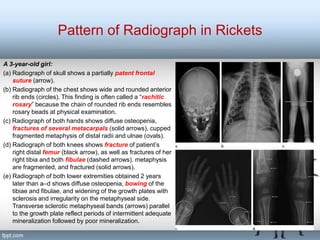 Radiograph of Skeletal System.pptmmmmmmmm | PPT
