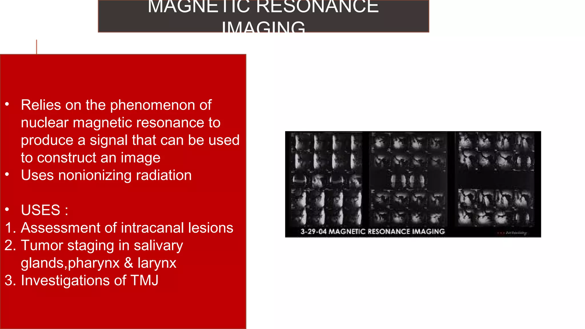 Radiographs in endodontic diagnosis PPT
