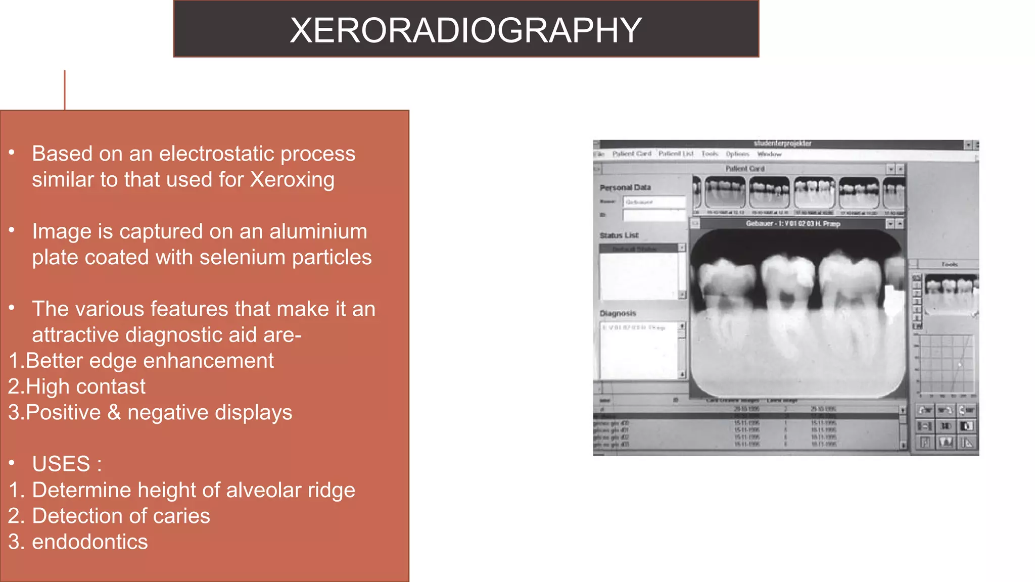 Radiographs in endodontic diagnosis PPT