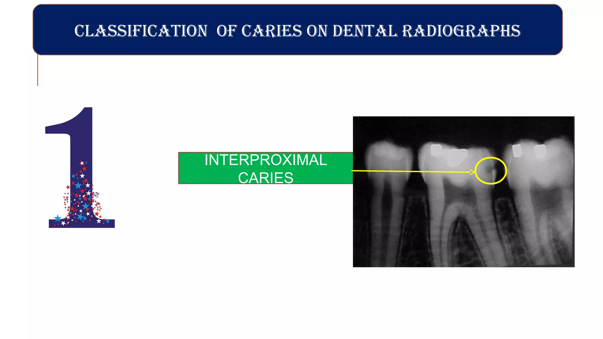 Radiographs in endodontic diagnosis PPT