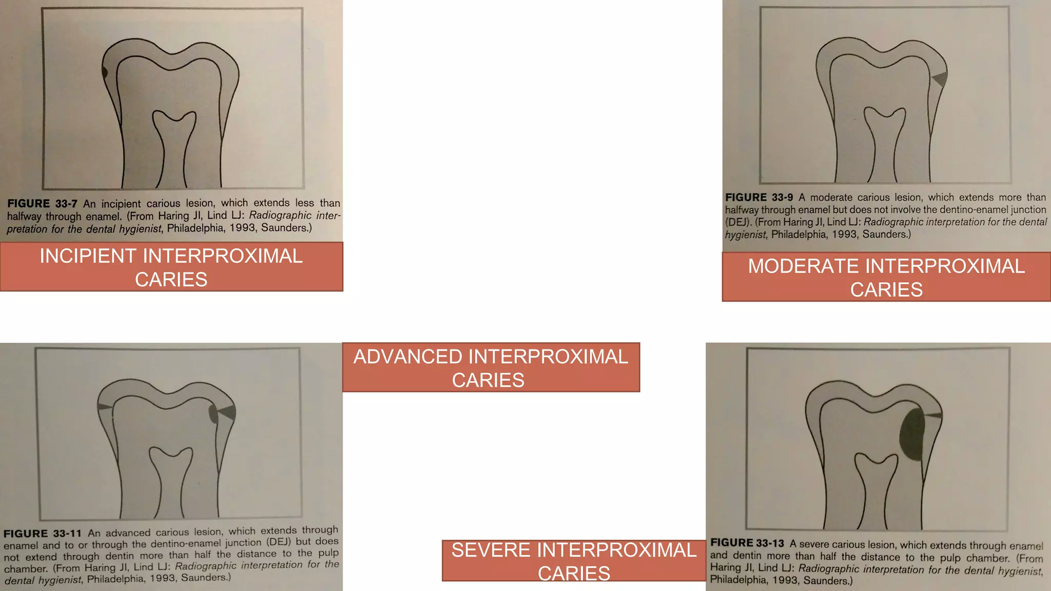 Radiographs in endodontic diagnosis PPT