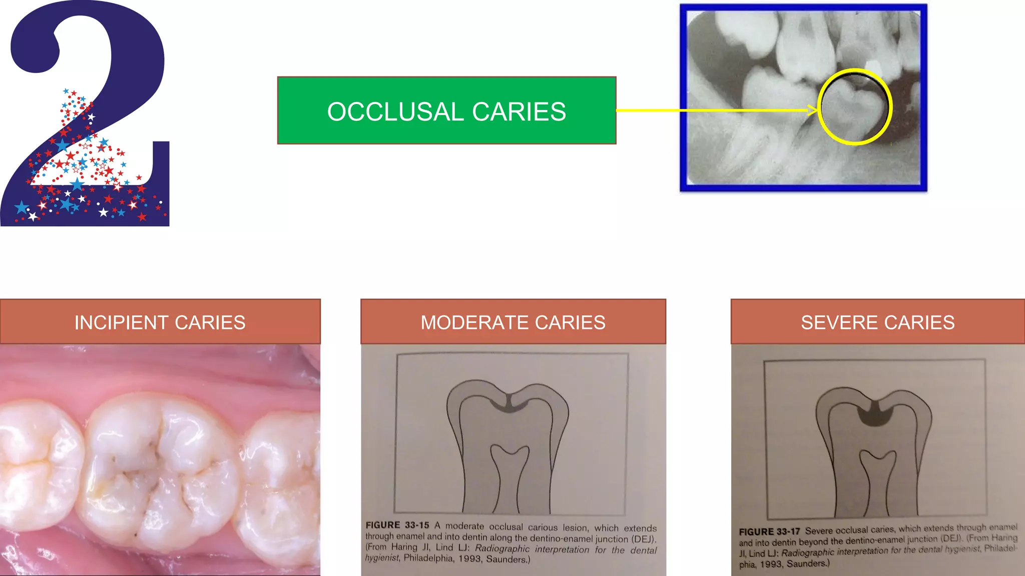 Radiographs in endodontic diagnosis PPT