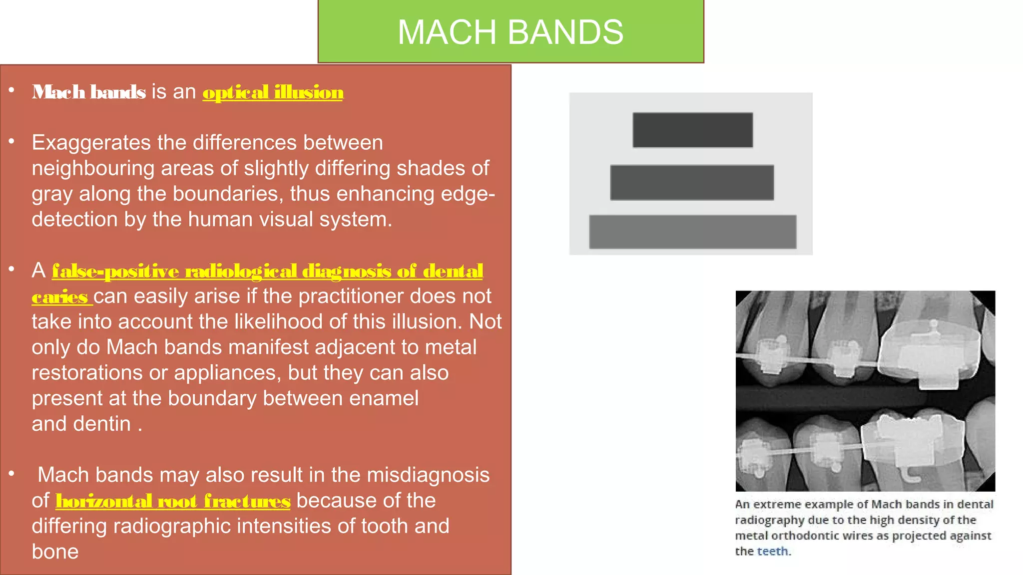 Radiographs in endodontic diagnosis | PPT