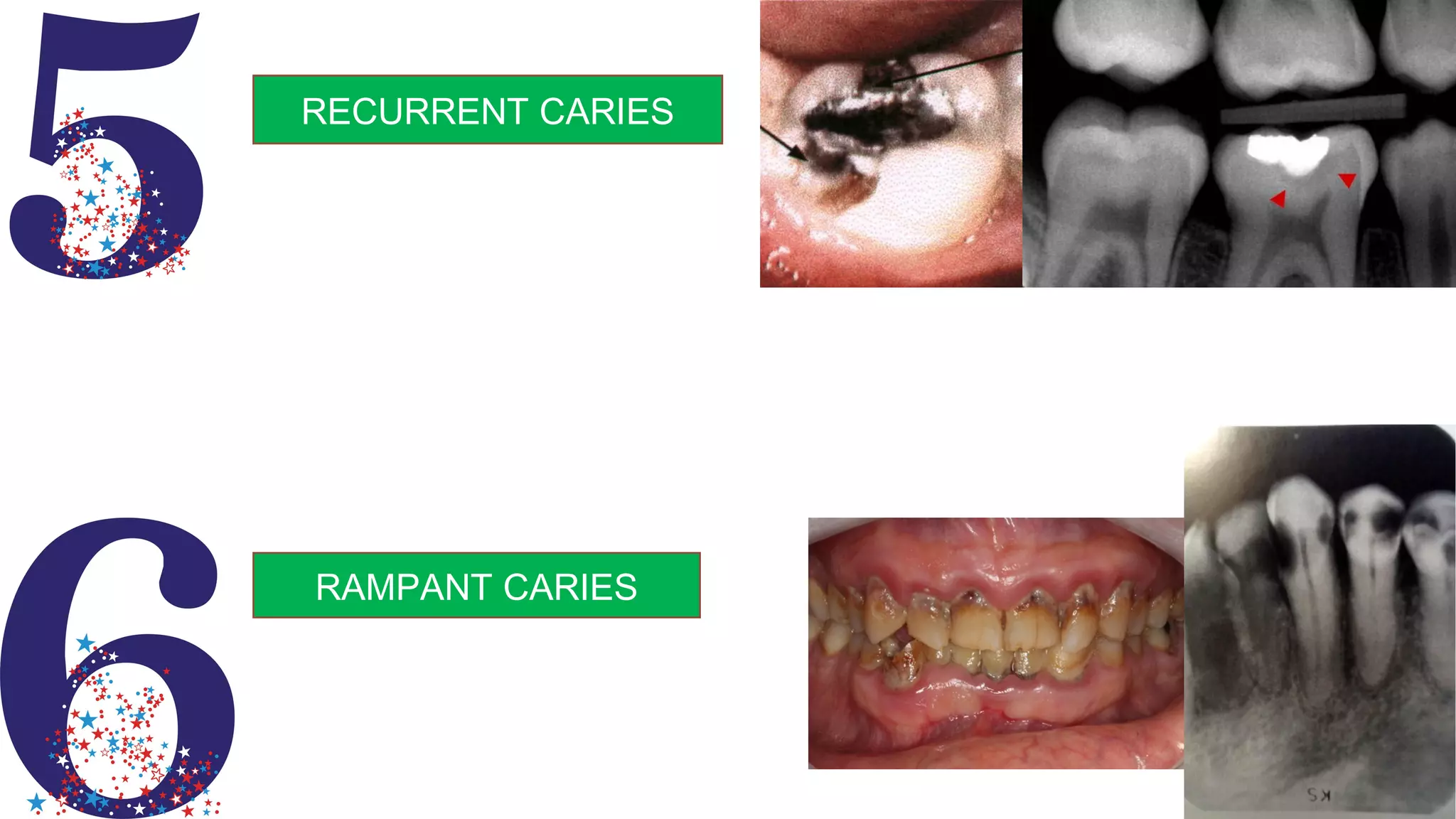 Radiographs in endodontic diagnosis PPT