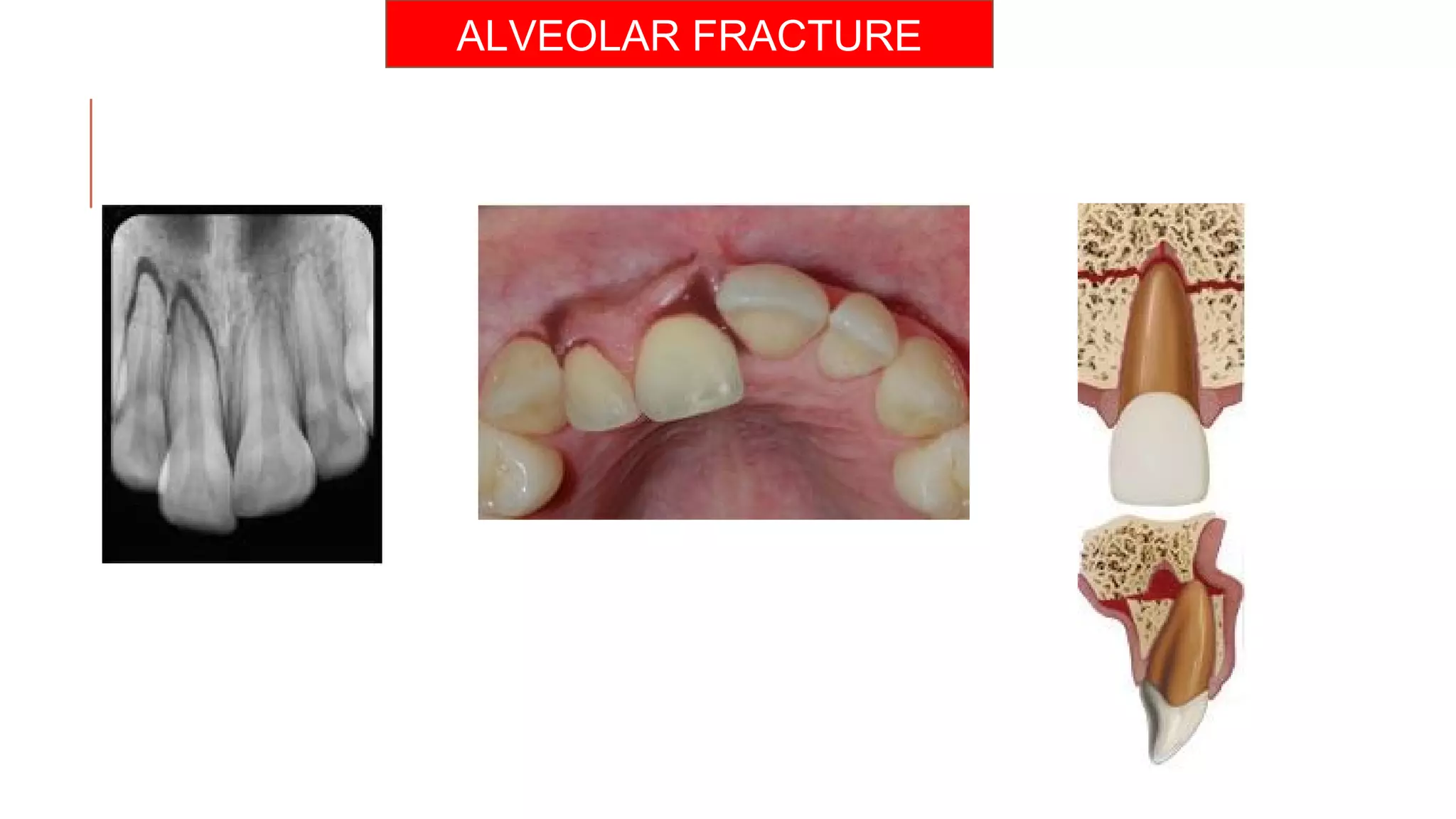 Radiographs in endodontic diagnosis PPT