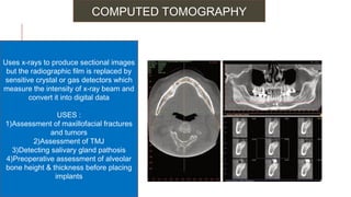 Radiographs in endodontic diagnosis | PPT