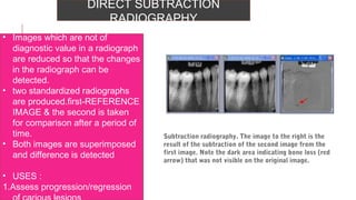 Substraction Radiograph Unit Radiographs in endodontic diagnosis | PPT