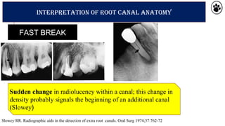 Radiographs in endodontic diagnosis | PPT