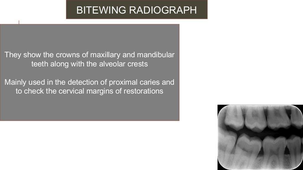 Radiographs in endodontic diagnosis