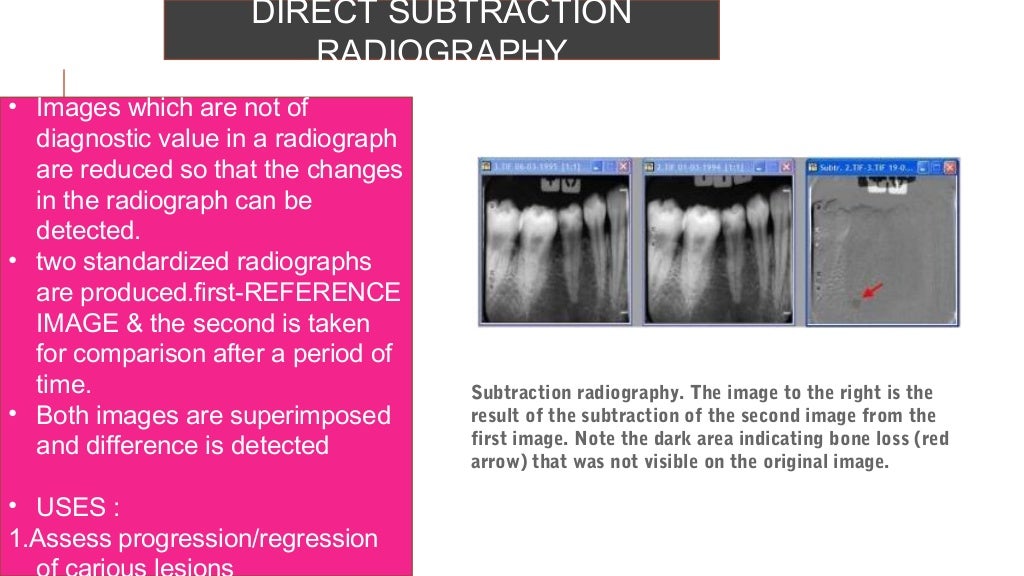 Radiographs in endodontic diagnosis