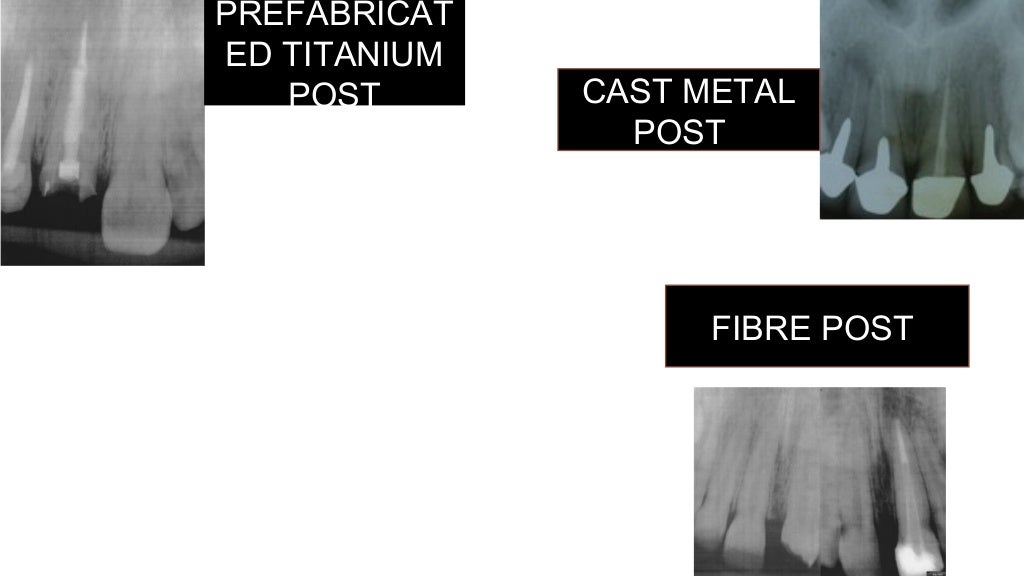 Radiographs in endodontic diagnosis