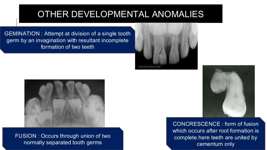 Radiographs in endodontic diagnosis