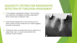 Radiographs | PPTX