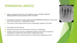 Radiographs | PPT