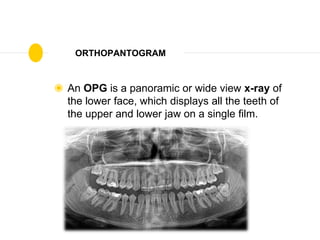 Radiographs in Operative | PPTX