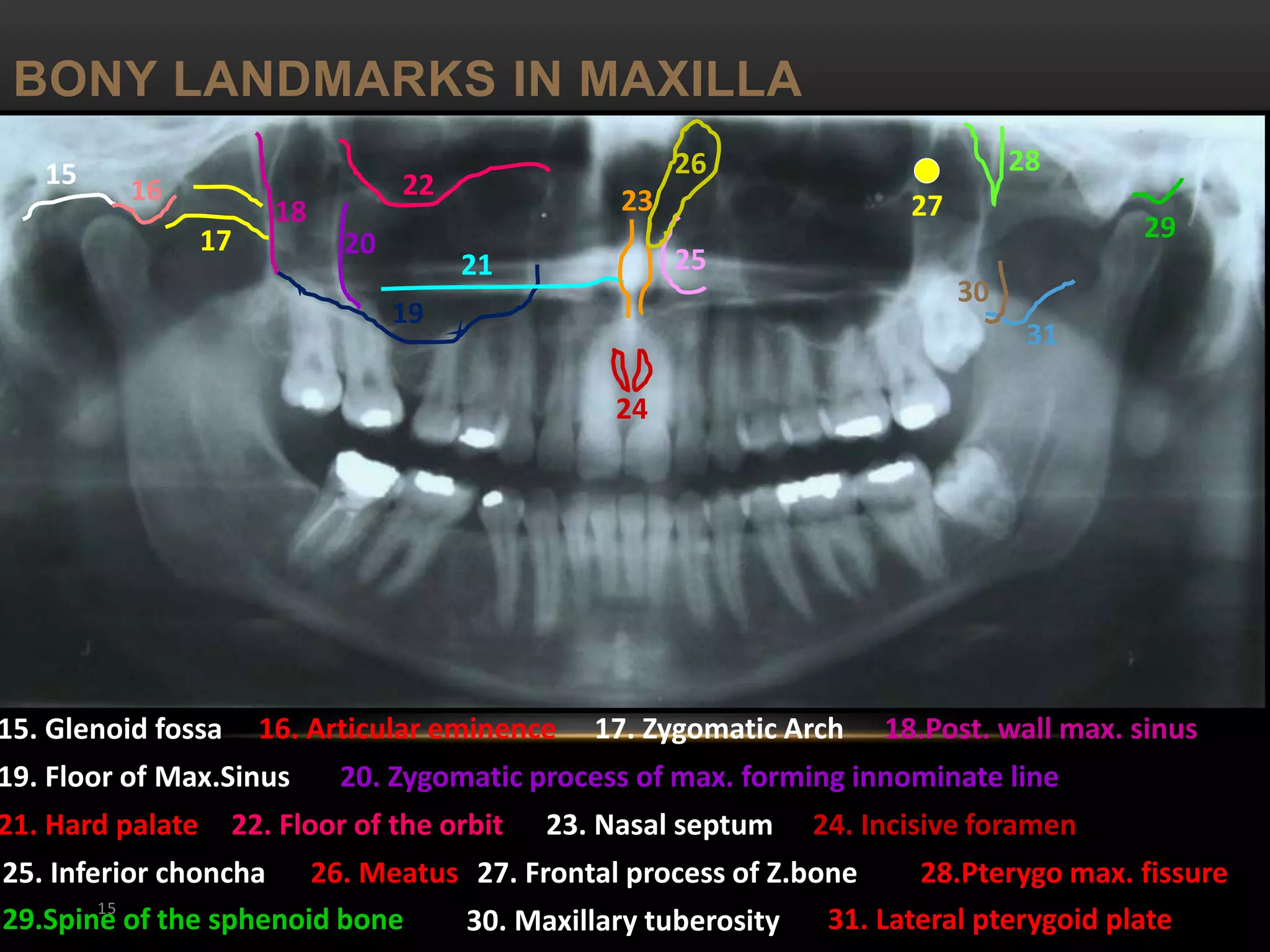 OPG and Extraoral radiography | PPTX