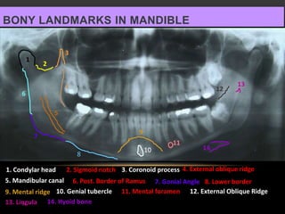 BONY LANDMARKS IN MANDIBLE
14
1
1. Condylar head 2. Sigmoid notch 3. Coronoid process 4. External oblique ridge
5. Mandibular canal
2
3
4
5
6. Post. Border of Ramus 8. Lower border7. Gonial Angle
6
7
9. Mental ridge 11. Mental foramen10. Genial tubercle
13. Lingula
12. External Oblique Ridge
14. Hyoid bone
8
9
10
11
12
13
 