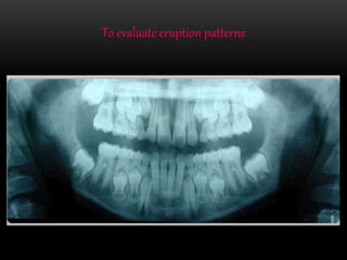 To evaluate eruption patterns
 